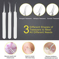10-Piece: Blackhead Remover Tool by DailySale