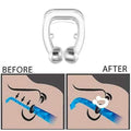 16-Pack: Silicone Magnetic Nose Clip Portable Mini Anti Snoring by DailySale