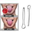 2-Pack: Stainless Steel Tongue Cleaner Scraper by DailySale