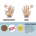 2-Pairs: Rheumatoid Arthritis Magnetic Compression Gloves by DailySale