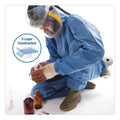 KleenGuard A60 Blood and Chemical Splash Protection Coveralls, X-Large, Blue, 24/Carton