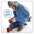 KleenGuard A60 Elastic-Cuff, Ankles and Back Hooded Coveralls, 3X Large, Blue, 20/Carton