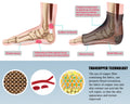 THX4COPPER Compression Foot Sleeves Copper Infused Arch Support Gray Navy Size L by Deal US