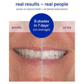 Supersmile Superstrips Teeth Whitening Dissolving Strips 14 by Pasteur Pharmacy