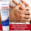 Eczema Relief Cream (Fast-Acting, Steroid-Free) – 4 oz