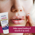 LipSore Healing Cream