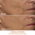 Dr Dennis Gross DRx SpectraLite FaceWare Pro LED Mask by Nava Beauty