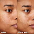 e.l.f. SKIN Holy Hydration! Thirst Burst Moisturizer Drops 1 fl oz - Imperfect Box by This is Beauty US
