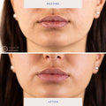 BioRepublic SkinCare Lip Masks 6pk - New by This is Beauty US