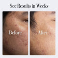 Geologie Clear System Skin Repair Moisturizer 0.2% Retinol 2 fl oz - Imperfect Box by This is Beauty US