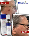 Scar & Stretch Mark Skin Recovery Oil with Cacay – Scar Treatment for Stretch Marks, New & Old Scars | Fast-Absorbing Dry Healing Oil
