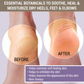 Cracked & Crusty Healthy Foot Cream by TriDerma MD
