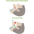 Anti Snoring Devices Chin Strap - Assorted Sizes by DailySale