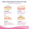 Blemish and Acne Treatment Skin Healing Spot Patches by DailySale