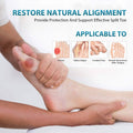 Bunion Corrector Big Toe Straightener Pain Relief by DailySale