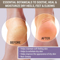 Cracked & Crusty Healthy Foot Cream by TriDerma MD