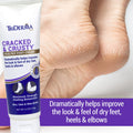 Cracked & Crusty Healthy Foot Cream by TriDerma MD