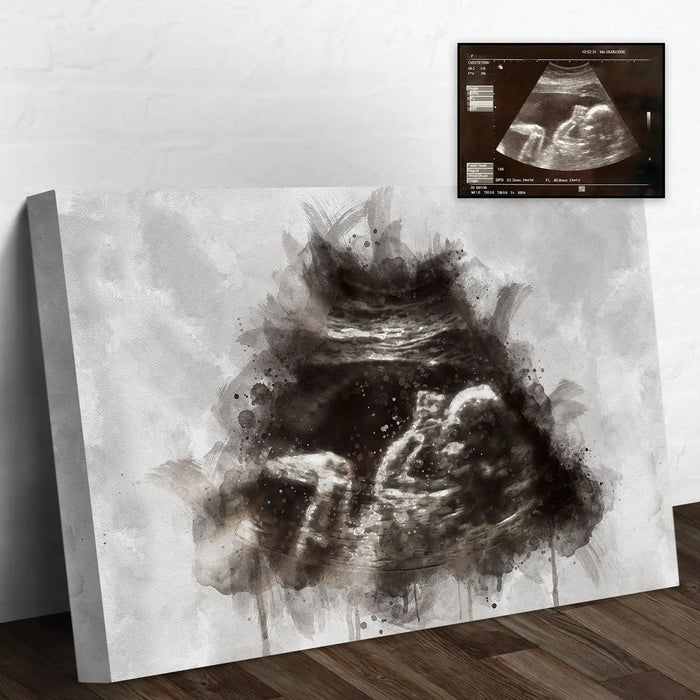 Custom Baby Ultrasound Watercolor Portrait by Tailored Canvases