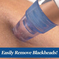 DermaSuction Blackhead Remover by DailySale
