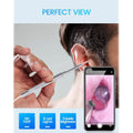 Digital Otoscope Camera with Light by DailySale