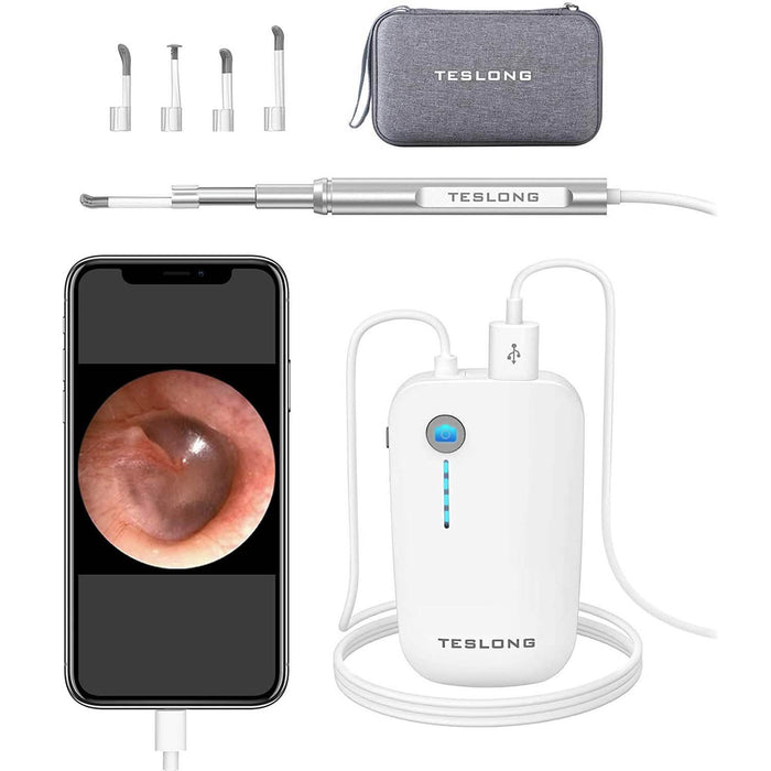 Digital Otoscope Camera with Light by DailySale