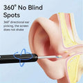 Ear Wax Removal Kit with Camera, Light and 6 Ear Spoons by DailySale