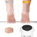 Electric Callus Grinder USB Rechargeable by DailySale