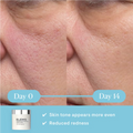 Elemis Dynamic Resurfacing Facial Pads 60pk by Nava Beauty