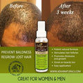 Hair Growth Booster (For Thinning or Balding Hair) by Adiva Naturals