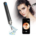 Intelligent Visual Ear Otoscope Inspection Tool by DailySale