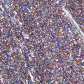 Light Elegance Glitter Gel - The Elvis Pelvis by The Nail Hub