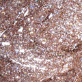 Light Elegance P+ Soak-Off Glitter Gel Polish - Champagne by The Nail Hub