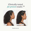 Nutrafol Women's Vegan Hair Growth Supplement Pack 3-Month Supply by Nava Beauty