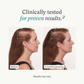 Nutrafol Women's Balance Hair Growth Pack 3-Month Supply by Nava Beauty
