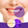 BestBy10/25 Rabbitooth Purple Teeth Whitening Serum 30ml Non-invasive Zero by Deal US