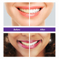 BestBy10/25 Rabbitooth Purple Teeth Whitening Serum 30ml Non-invasive Zero by Deal US