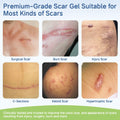 BestBy06/27 SLUKHIG Silicone Scar Gel 1.76oz Surgical & Burn Scar TreatmentCream by Deal US
