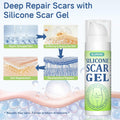 BestBy06/27 SLUKHIG Silicone Scar Gel 1.76oz Surgical & Burn Scar TreatmentCream by Deal US