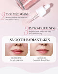 Moika Peach 70 Niacinamide Serum 30ml Hydrating Brightening Face Serum - New by Deal US