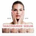 Moika Peach 70 Niacinamide Serum 30ml Hydrating Brightening Face Serum - New by Deal US