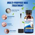 Wunila Toenail Fungus Treatment Extra Strength 30ml Multi-Purpose Nail Repair by Deal US