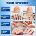 Wunila Toenail Fungus Treatment Extra Strength 30ml Multi-Purpose Nail Repair by Deal US
