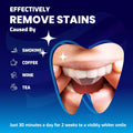 Care Enamel Whitening Strips Teeth Whitener Kit Mint 28 Strips by Deal US