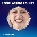 Care Enamel Whitening Strips Teeth Whitener Kit Mint 28 Strips by Deal US