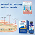 BestBy01/27 Toenail Fungus Treatment Extra Strength with Tolnaftate MultiPurpose by Deal US