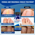 BestBy01/27 Toenail Fungus Treatment Extra Strength with Tolnaftate MultiPurpose by Deal US