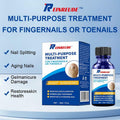 BestBy01/27 Toenail Fungus Treatment Extra Strength with Tolnaftate MultiPurpose by Deal US