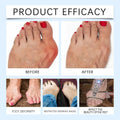 Befada Bunion Cushions Patch Waterproof Adhesive Pads for Men & Women 10 Tablets by Deal US