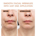 ENROSLU Face Wrinkle Patches 256Pcs Clear Reusable Anti-Wrinkle Treatment by Deal US