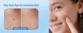 Chic Glamour Emporium Pimple Patch Hydrocolloid Acne Spot Stickers 72 Count by Deal US